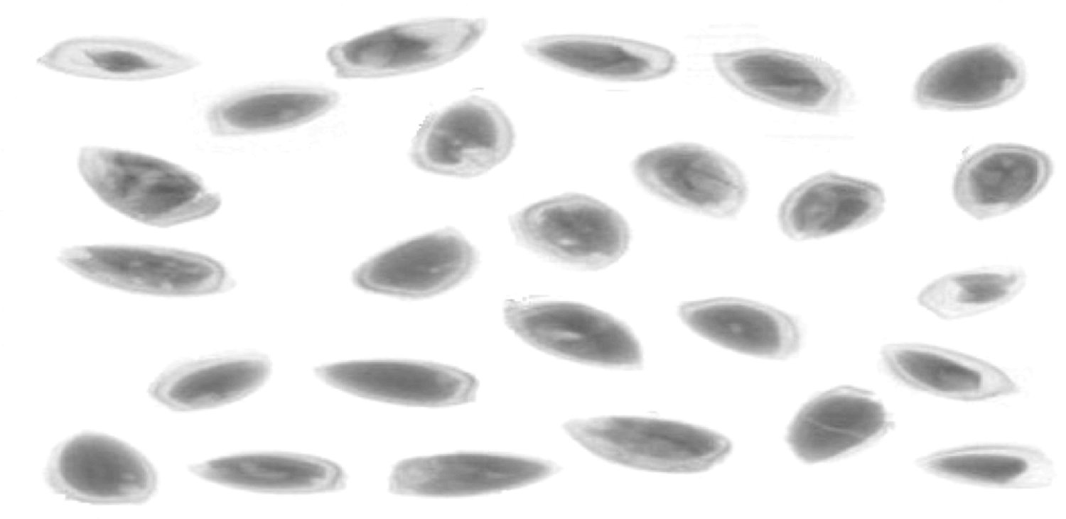 TOMRA 5X defect detection