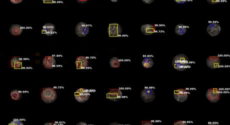 TOMRA artificial intelligence