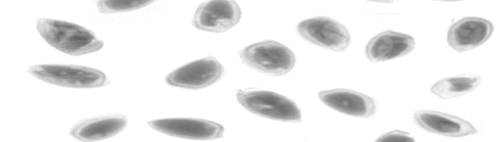 TOMRA 5X defect detection